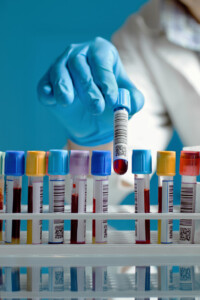 Test: Gefluegelpest/Vogelgrippe/H5N8