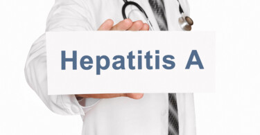 Hepatitis A