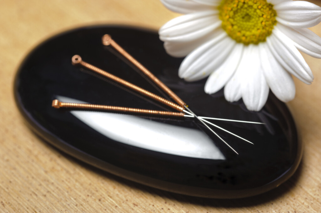 Akupunktur in der Schwangerschaft - Akupunktur