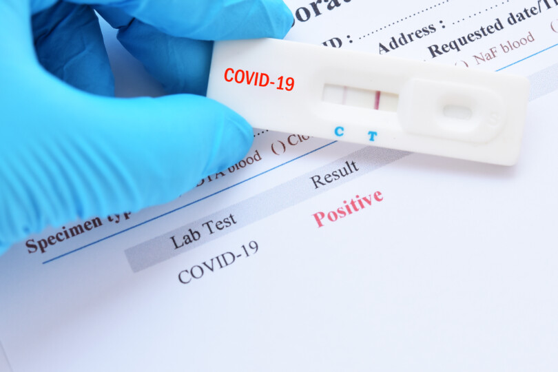 COVID-19 positiver Test