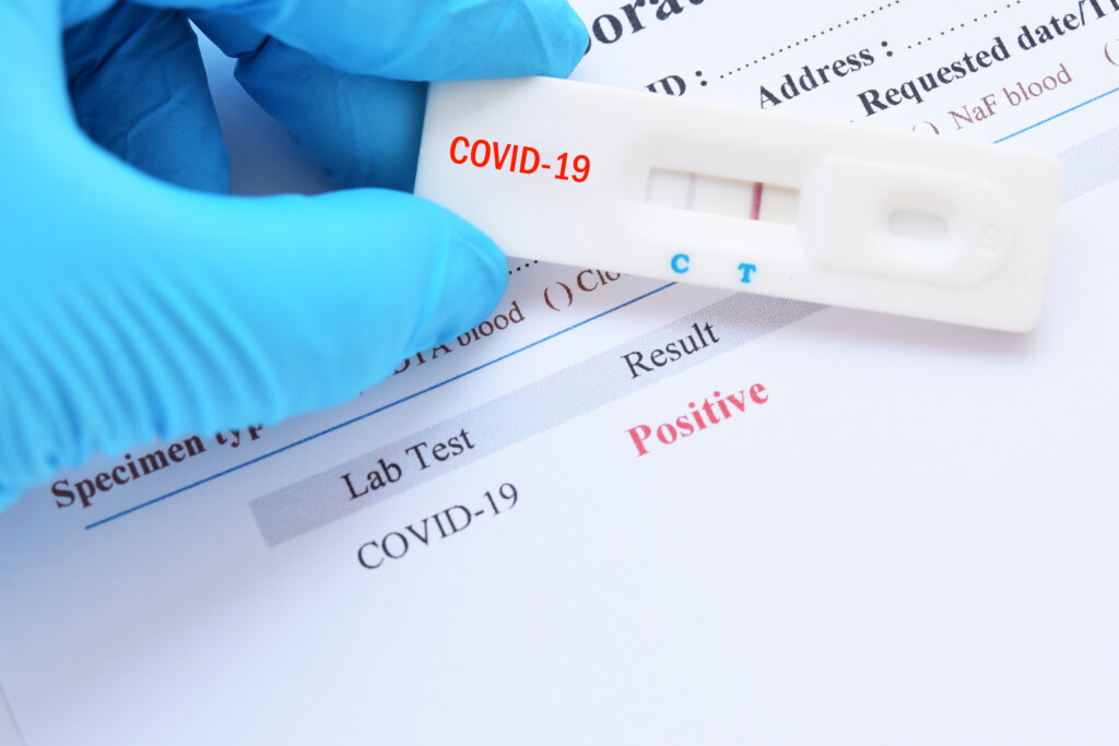 Corona-Test prositiv