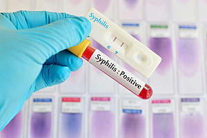 Syphilis: frühzeitige Therapie garantiert vollständige Heilung