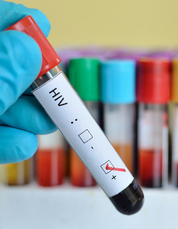 AIDS Symptome, Ansteckung & Behandlung medizinfuchs.de